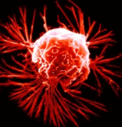 Ovarian Cancer News & Articles |.